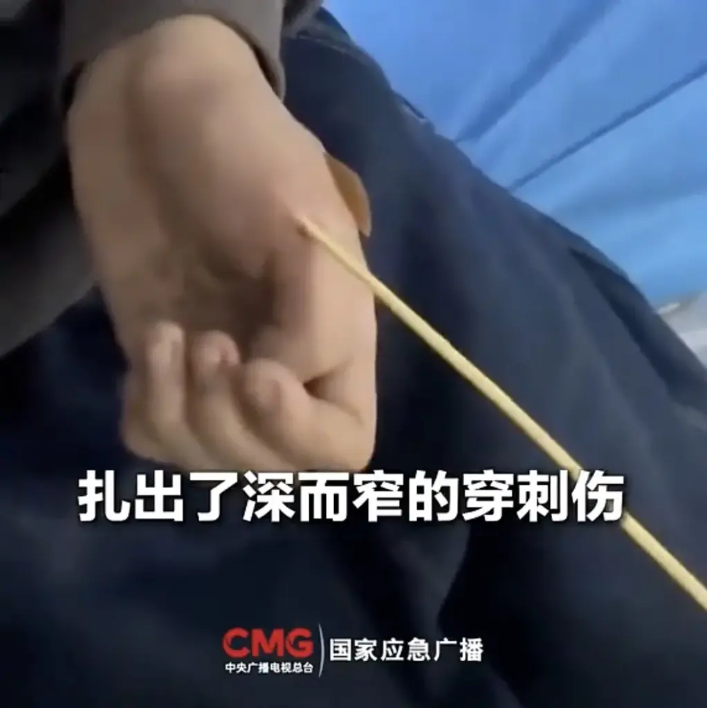 上山砍毛竹突然被“刺”，处置不当可能诱发致命感染！医生提醒→