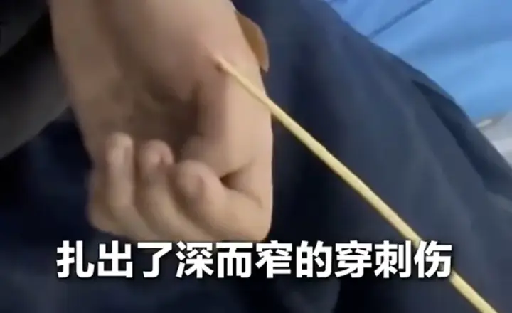 上山砍毛竹突然被“刺”，处置不当可能诱发致命感染！医生提醒→